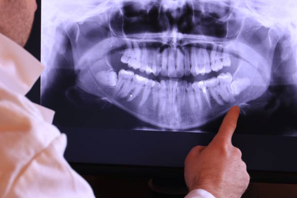 Best Emergency Denture Repair in Eau Claire, WI